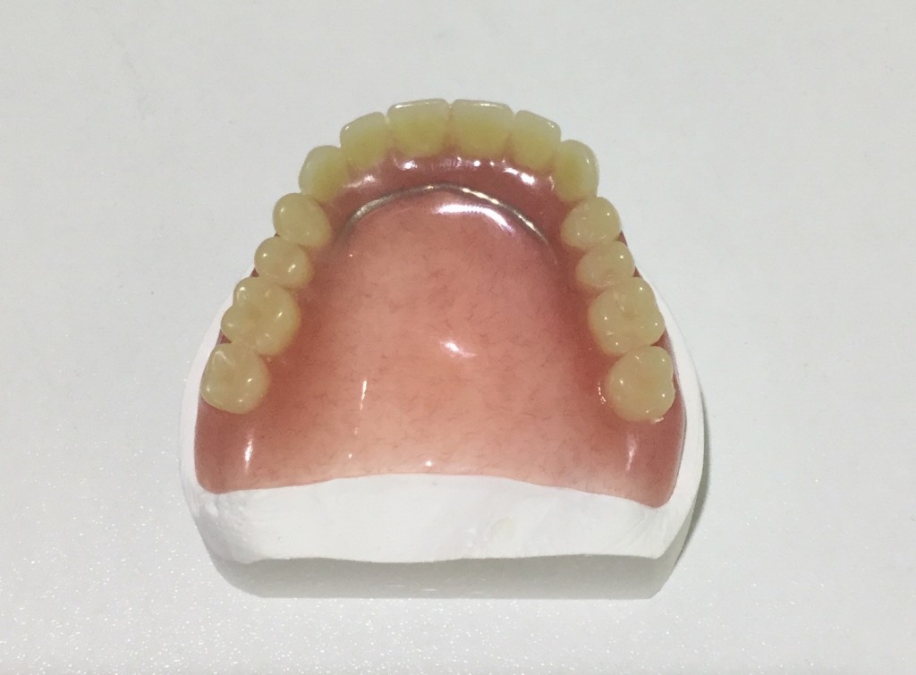 総入れ歯の欠点