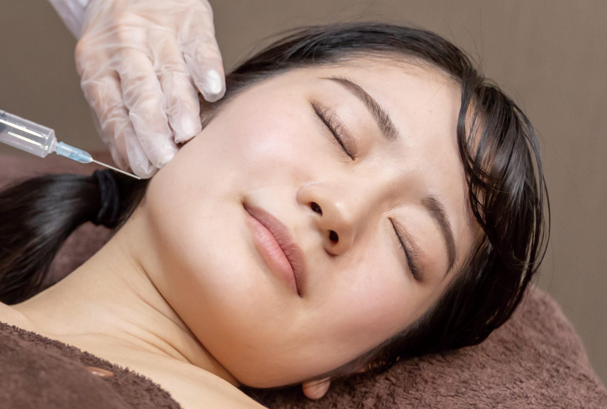 ボトックス注入