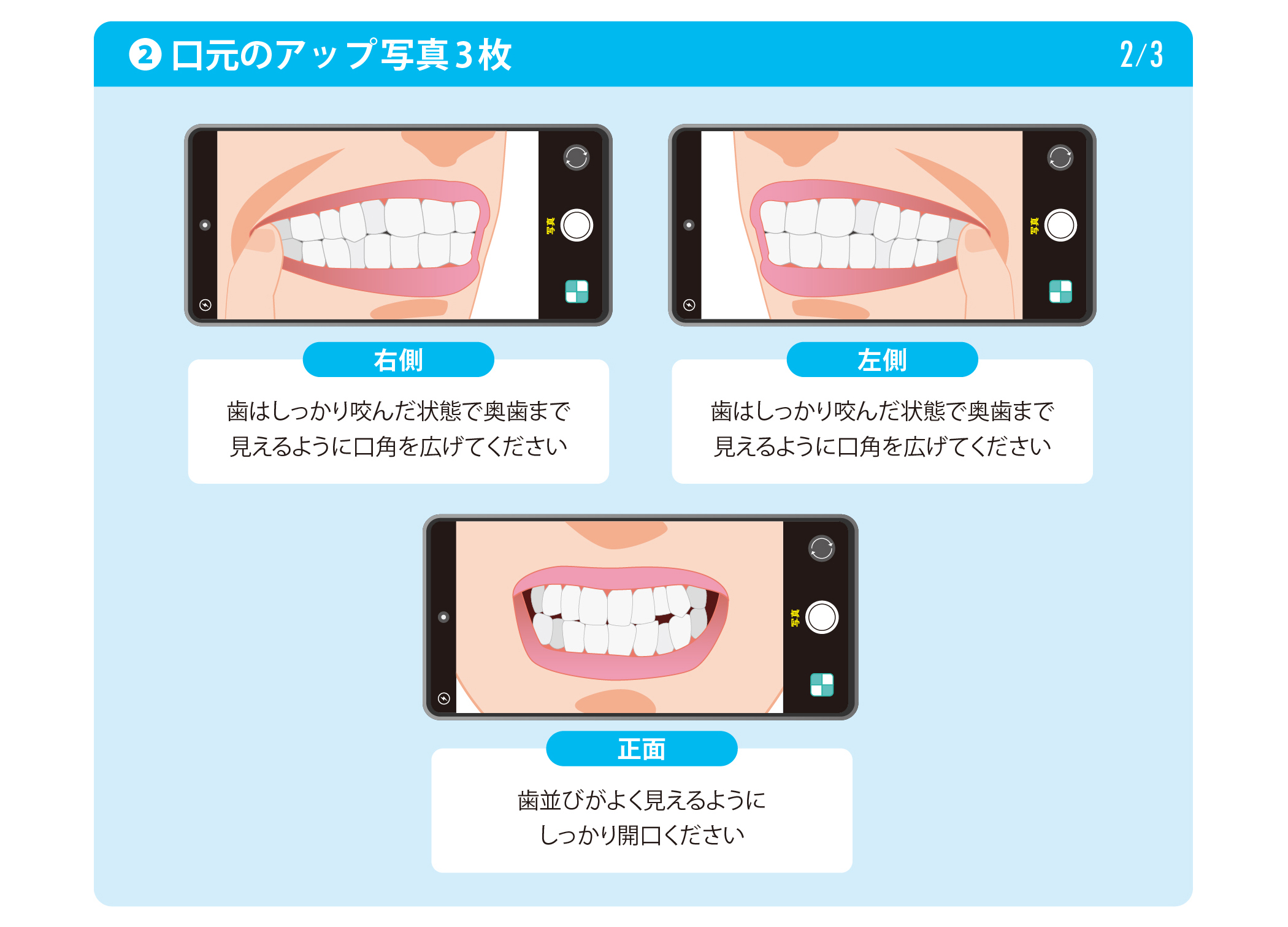 口元のアップ写真3枚