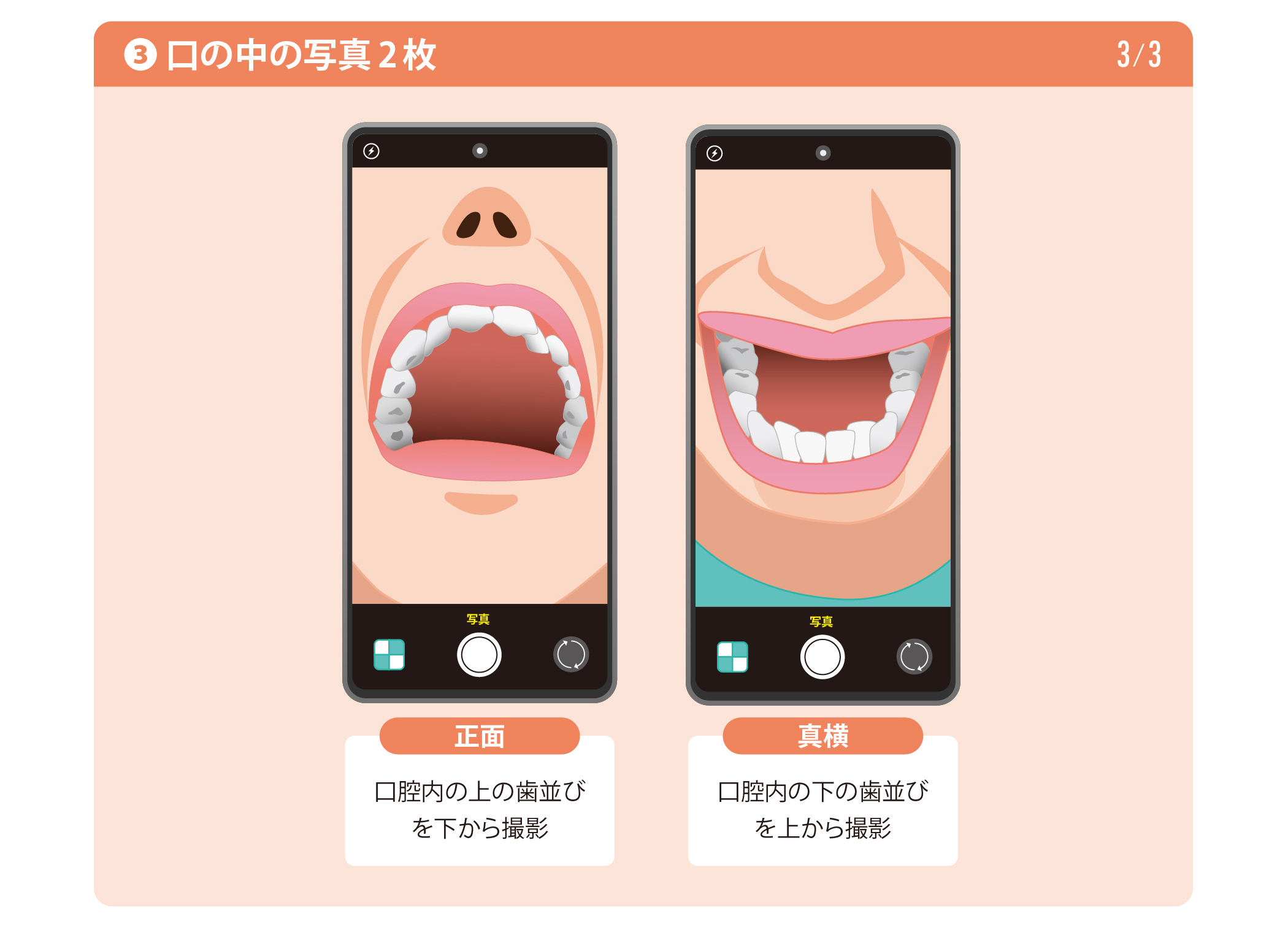口の中の写真2枚