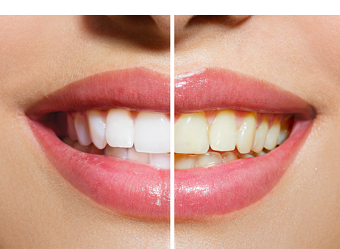 ビフォーアフターイメージ